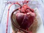Bijúce ľudské srdce v zariadení TransMedics OCS