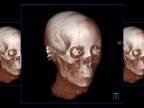 Rekonštrukcia tváre 2000-ročnej múmie ženy