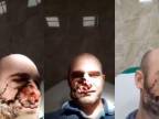 Vojak vo vojne na Ukrajine prišiel o časť tváre (18+)