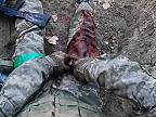 Ťažko zranený ukrajinský vojak kričí, že je ranený