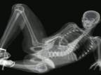 Sexy kosť pod röntgenom