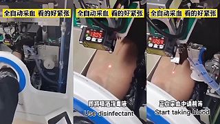 Tento čínsky robot dokáže človeku odobrať krv, nahradí prácu sestričky