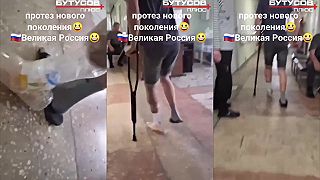 video Ruská protetika na svetovej úrovni