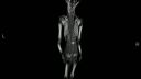 CTScan Atacama alien.