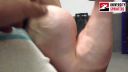 škoticeps biceps