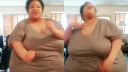 Miriam má 200 kg, no cíti sa dobre!