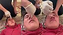 Keď chiropraktik rieši upchatý nos