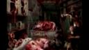 MALIGNANCY - Bag