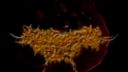 Meningococcemia Fecal - Bizaare Rectal Explotion