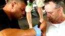 video Odstraňovanie tetovania brúskou