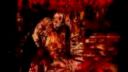 Proctohematorrea - Herramientas De Tortura