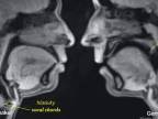 Ľudské telo "očami" MRI
