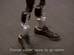 Testovanie nových inteligentných bionických protéz