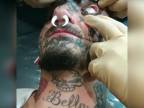 Čo takto tetovanie očnej buľvy?