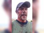50-ročný muž a jeho video tesne po útoku grizlyho!