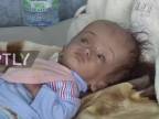 Jemen: novorodenecké deformácie sa množia po dvoch rokoch voj