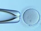 ICSI oplodnenie vajíčka pod mikroskopom