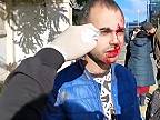 Ošetrovanie ranených v Kyjeve
