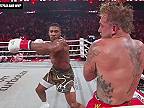 Jake Paul vs Anthony Joshua - youtuber skončil so zlomeninou sánky