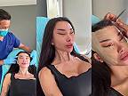 Ďalšia spokojná klientka plastickej chirurgie