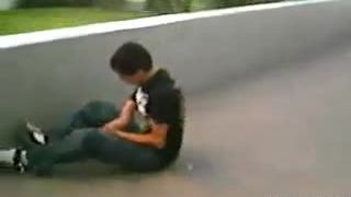 Nepríjemný pád zo skejtu a následna otvorena zlomenina