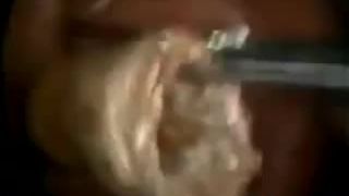 Domáca výroba vosku (India)