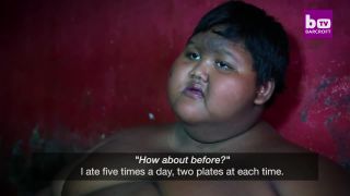 10-ročný chlapec s morbídnou obezitou