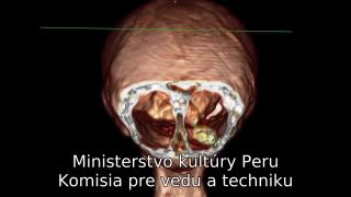 ROJPRSTÉ MÚMIE Z NASCA NA VEDECKOM KONGRESE V PERU!