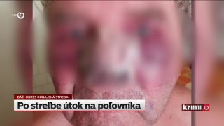 Krvavá dohra po postrelení psa: Poľovníka brutálne dobili