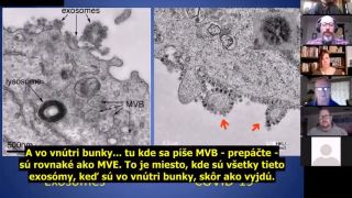 Údajný vírus COVID - 19 verzus exozómy (Dr. Andrew Kaufman)