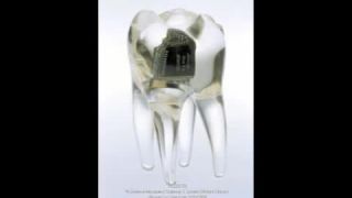 Audio implantáty EN