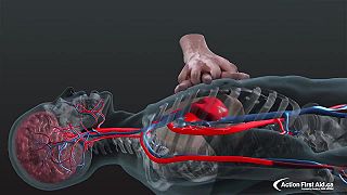 Čo sa deje počas kardiopulmonálnej resuscitácie (CPR) v 3D