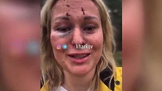 Matka ktorá prežila ostreľovanie Charkova okupantami