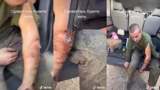 Okupant sa dostal do zajatia s ranou plnou červovu