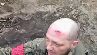 Šťastný ruský vojak ukazuje prilbu, cez ktorú preletela guľka a šuchla mu čelo