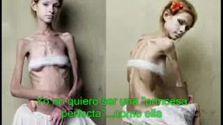 Anorexia a bulímia