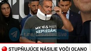 Jozef Pročko-diagnóza:Pohmoždená hlava s odreninou a podvrtnutie krčnej chrbtice