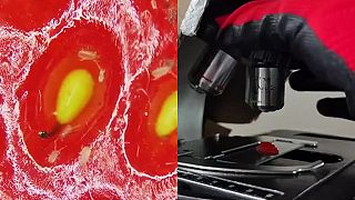 Jahoda pod mikroskopom