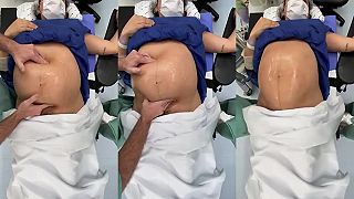 Gynekológ otáča dieťa v matkinom bruchu, aby sa predišlo cisárskemu rezu