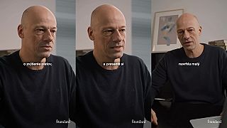 Nadštandardne platení lekári na Slovensku sa pohybujú na hrane výpalníctva