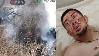 Rus ktorý prežil priamy zásah tankom