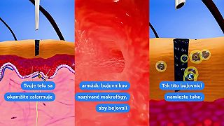 Čo sa stane keď si dáš tetovanie?