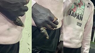 Ty si ale poriadne blbý nigga, s malíčkom sa môžeš rozlúčiť (DRSNÉ)