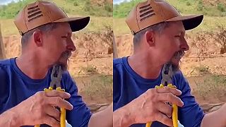 video Depilácia brady pomocou kombinačiek?