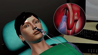 Nosné dutiny a ich ošetrenie balónovou terapiou