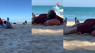 video Také monštruózne palce na nohách ste ešte nevideli!