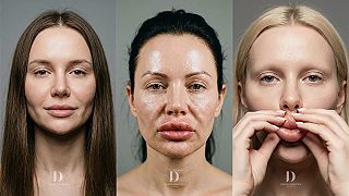 video Kačacie pery už nie sú v móde?