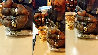 video Bezmozok si pomocou prsteňov „amputoval” prsty (DRSNÉ ZÁBERY)