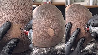 video Vlasy už síce nemám, no dal som si ich vytetovať