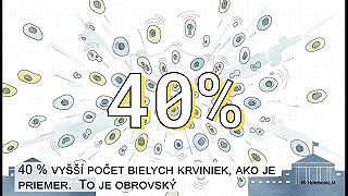 Vedeli to celé desaťročia - Temná história Havanského syndrómu